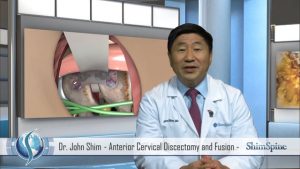 Anterior Cervical Discectomy and Fusion Operation